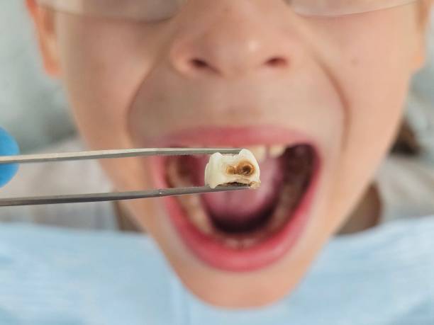 Best Walk-In Emergency Dentist in Beebe, AR
