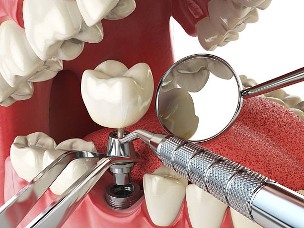 Best Emergency Treatment for Toothache in Beebe, AR